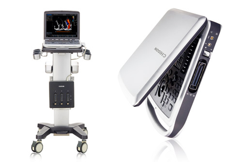 CHISON Sonobook 7 УЗИ аппарат