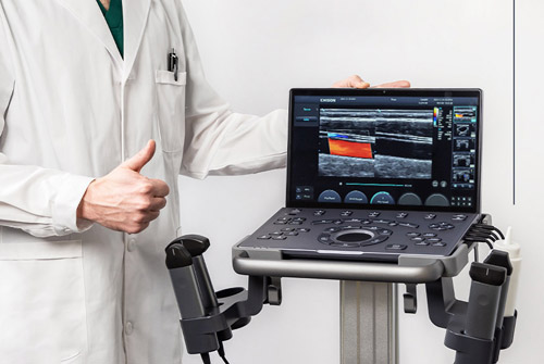CHISON Sonotouch 50 Ultramatrix УЗИ аппарат