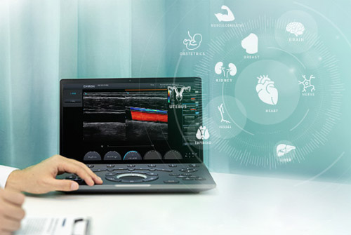 CHISON Sonotouch 50 Ultramatrix УЗИ аппарат